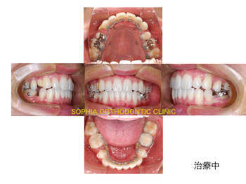米.002.jpg