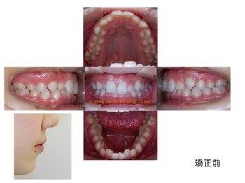 OSA.001.jpg